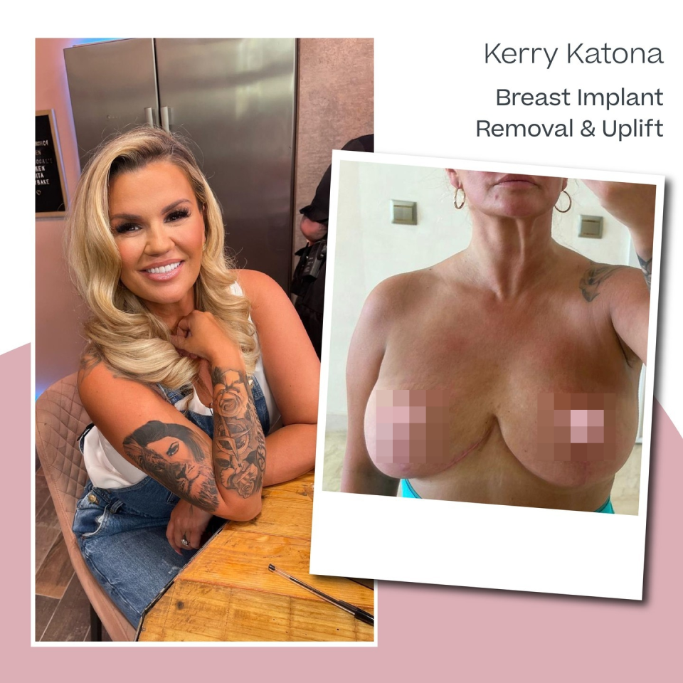 Kerry Katona bares all as she reveals the results of her boob surgery
