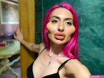 Woman with worlds biggest cheeks looks completely different without 1500 f