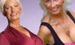 Welsh great-grandmother Joan Lloyd gets boob job at 65