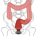 An In-Depth Guide to Anal Training Stretching Gaping