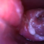 Play with Speculum and view inside my Pussy by inside Camera