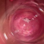 Camera deep inside Mias vagina