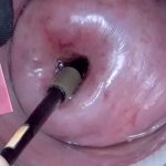 Mature Milf Cervix Play with Endoscope Japanese Cam into Uterus