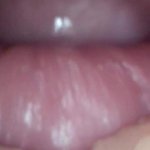 Andrada endoscope pussy fuck