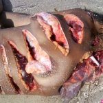 Compilation of Nude Girl Naked Dead Woman Autopsy