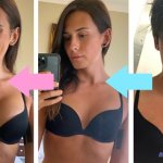 mtof hormone boobs pics