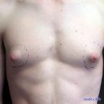 puffy boobs