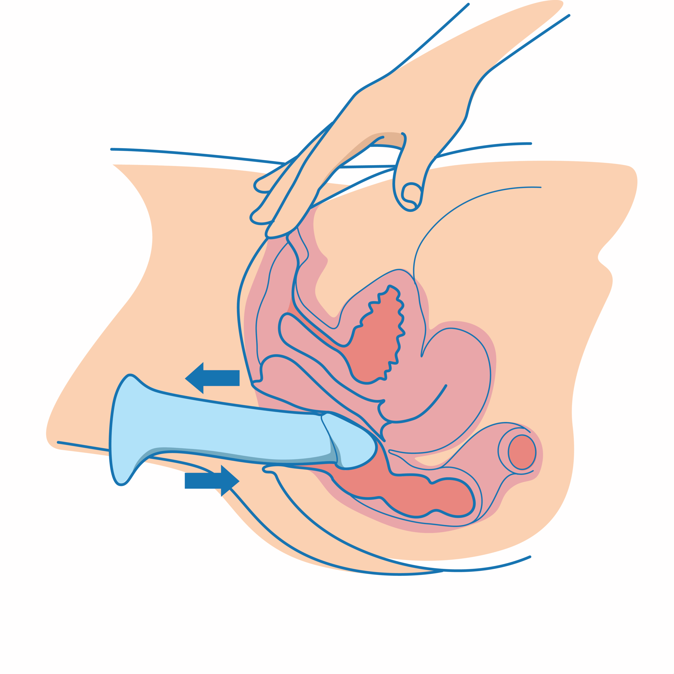 Anal with dildo