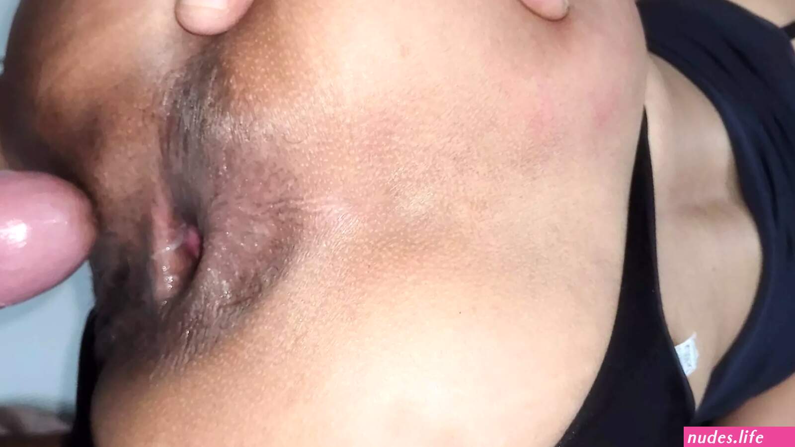 Coroa asiatica anal