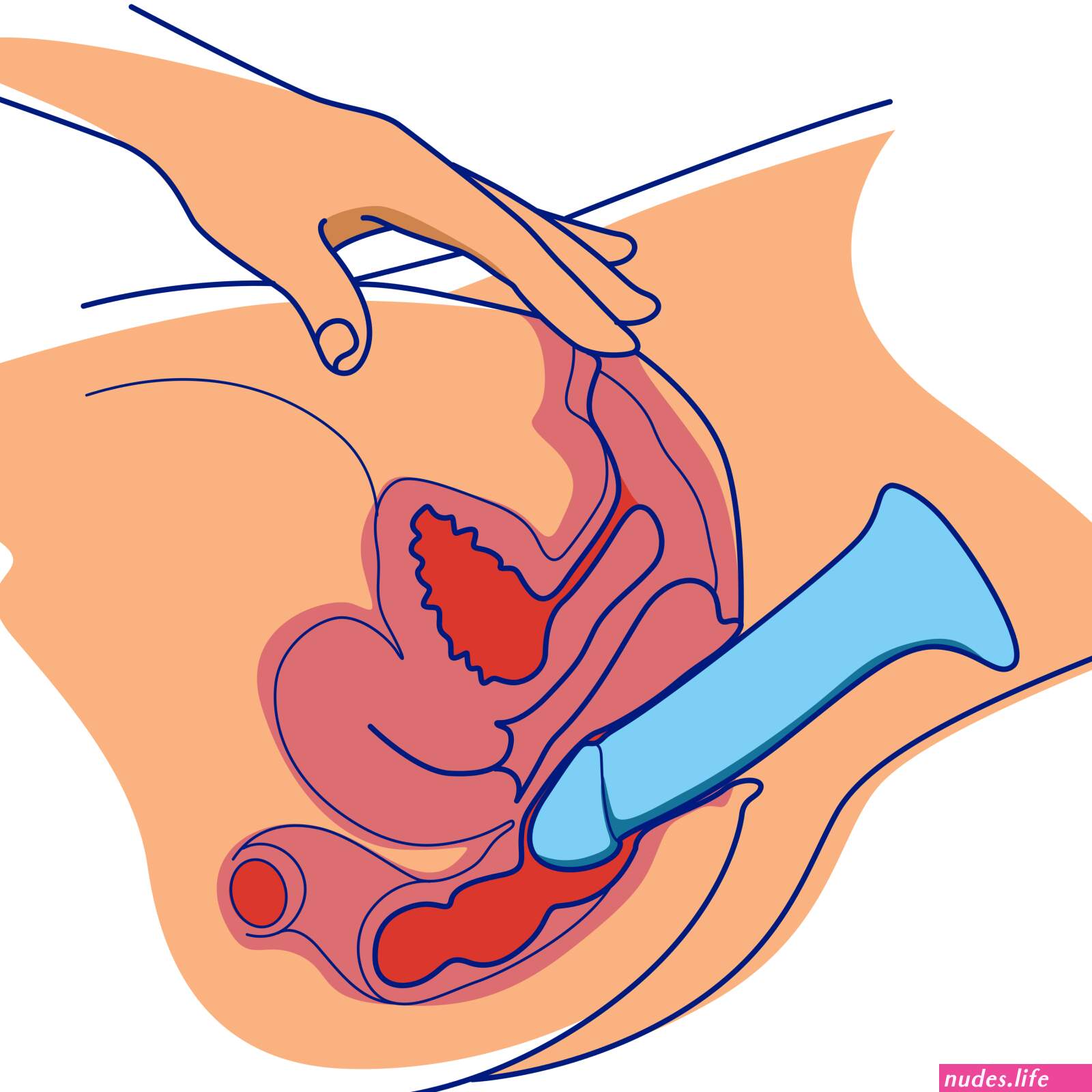 Rectal dildo